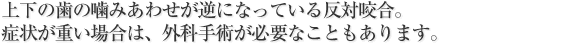 上下の歯の噛みあわせが逆になっている反対咬合。
症状が重い場合は、外科手術が必要なこともあります。